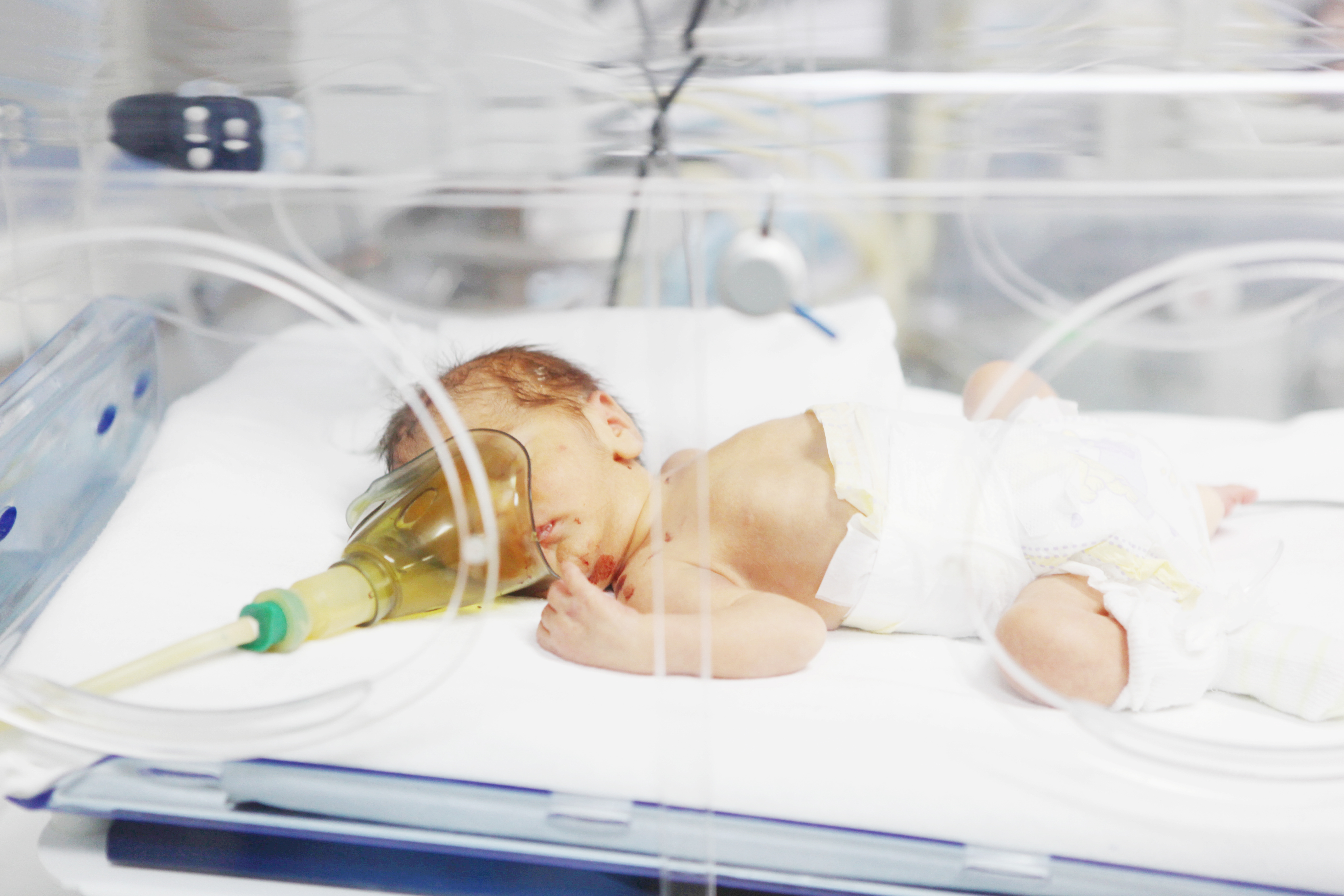 Image of a child in incubator - born too early